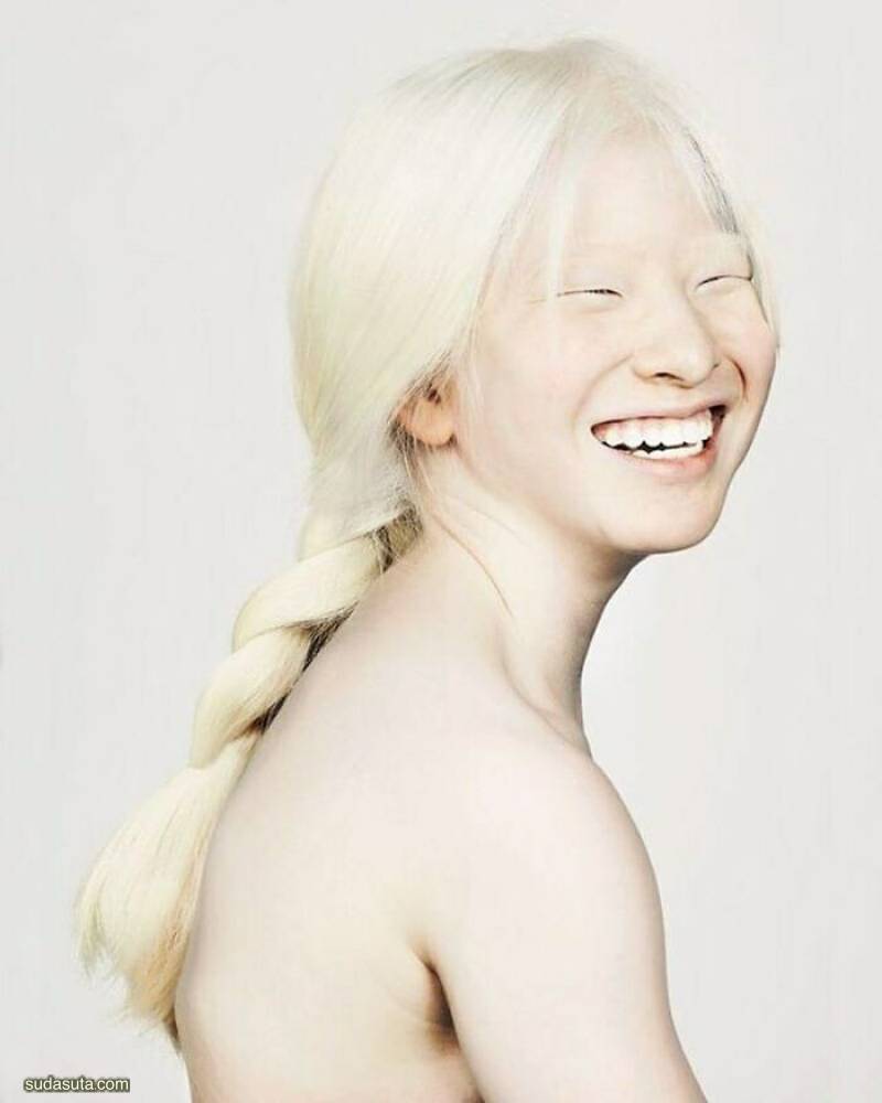 Albinism 时尚人像摄影欣赏