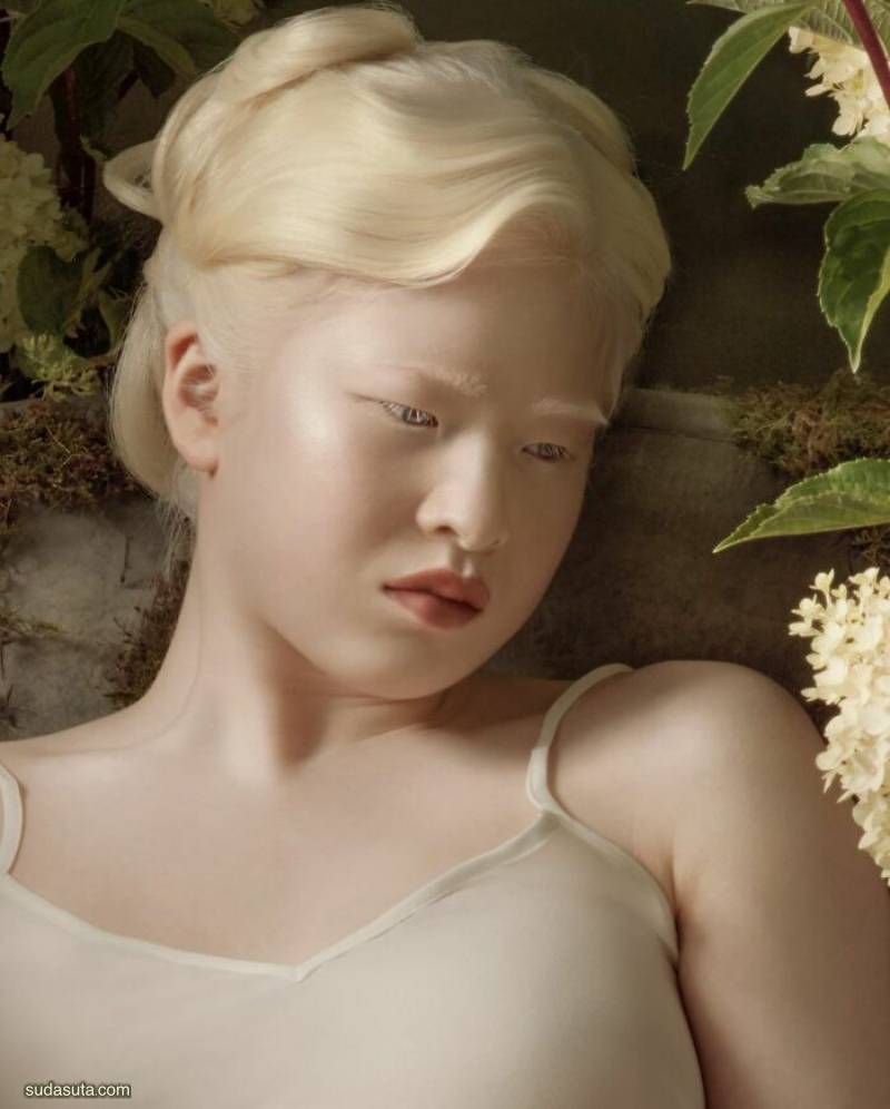Albinism 时尚人像摄影欣赏